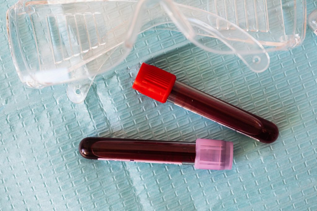 tubos de coleta de sangue para analisar os riscos do colesterol alto