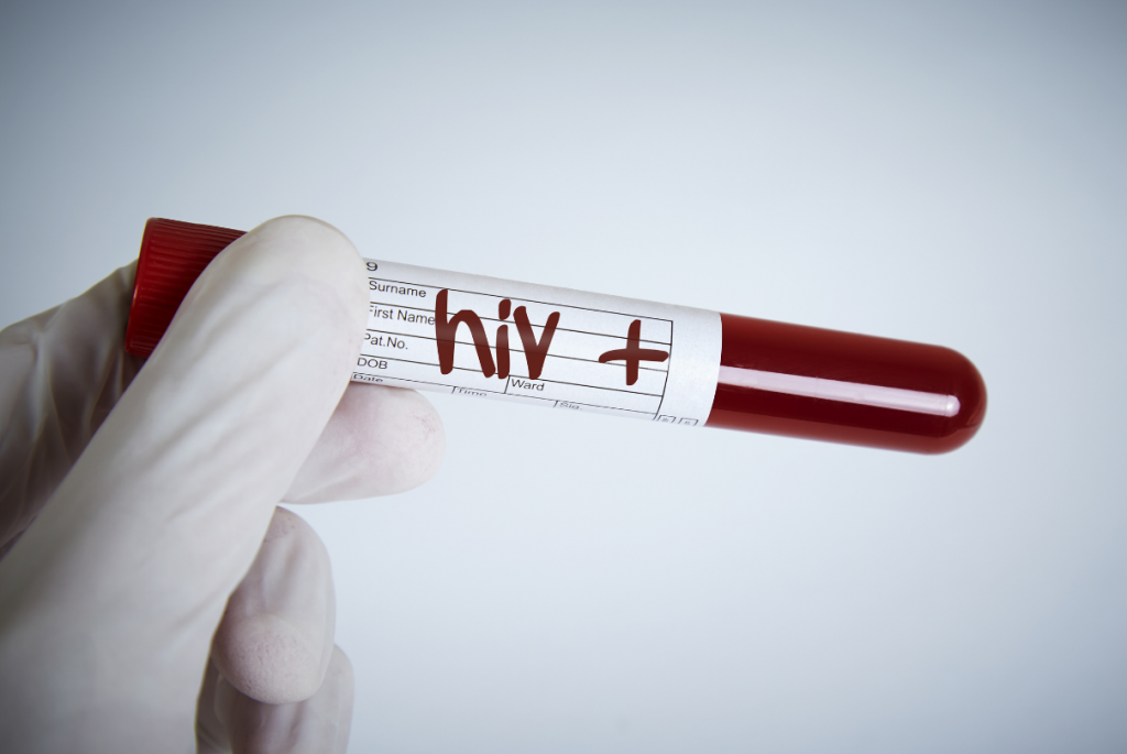 Tubo de sangue HIV positivo