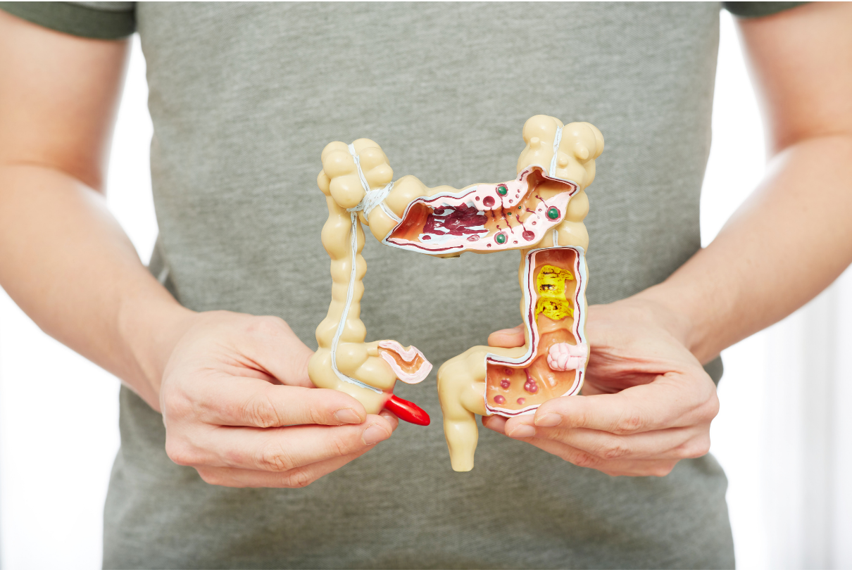 Pessoa segurando intestino