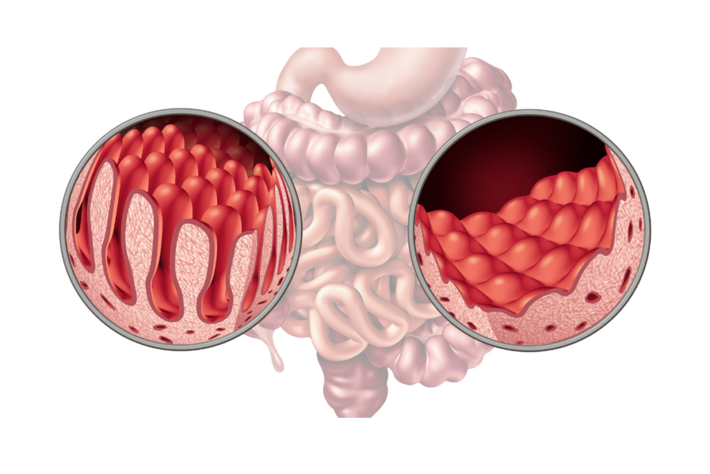 Intestino e vilosidades