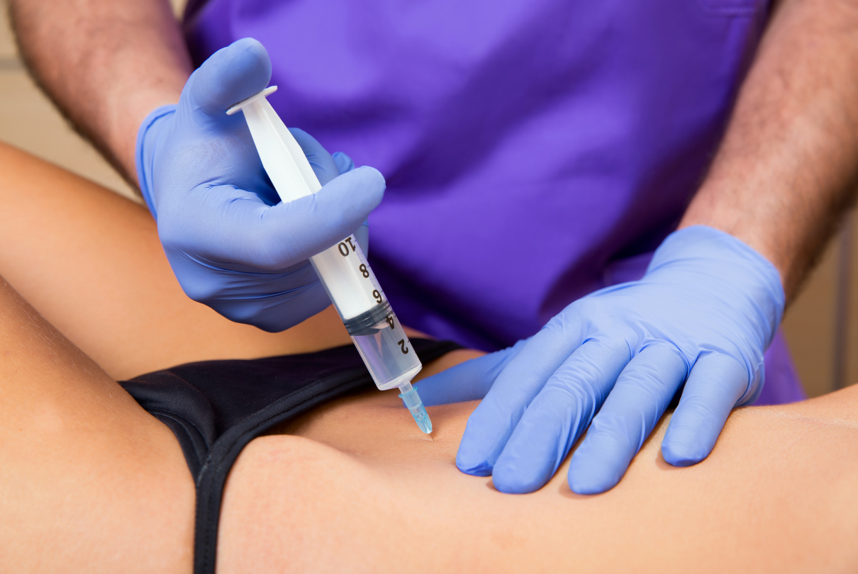 Mesoterapia no abdome