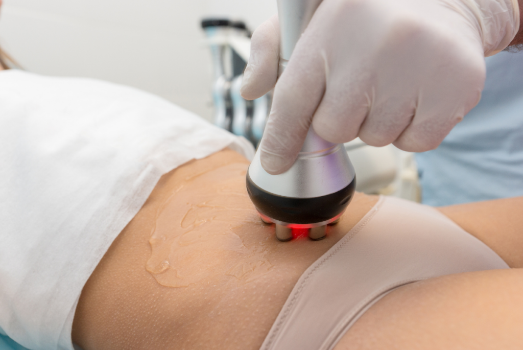 Mulher fazendo radiofrequência na barriga