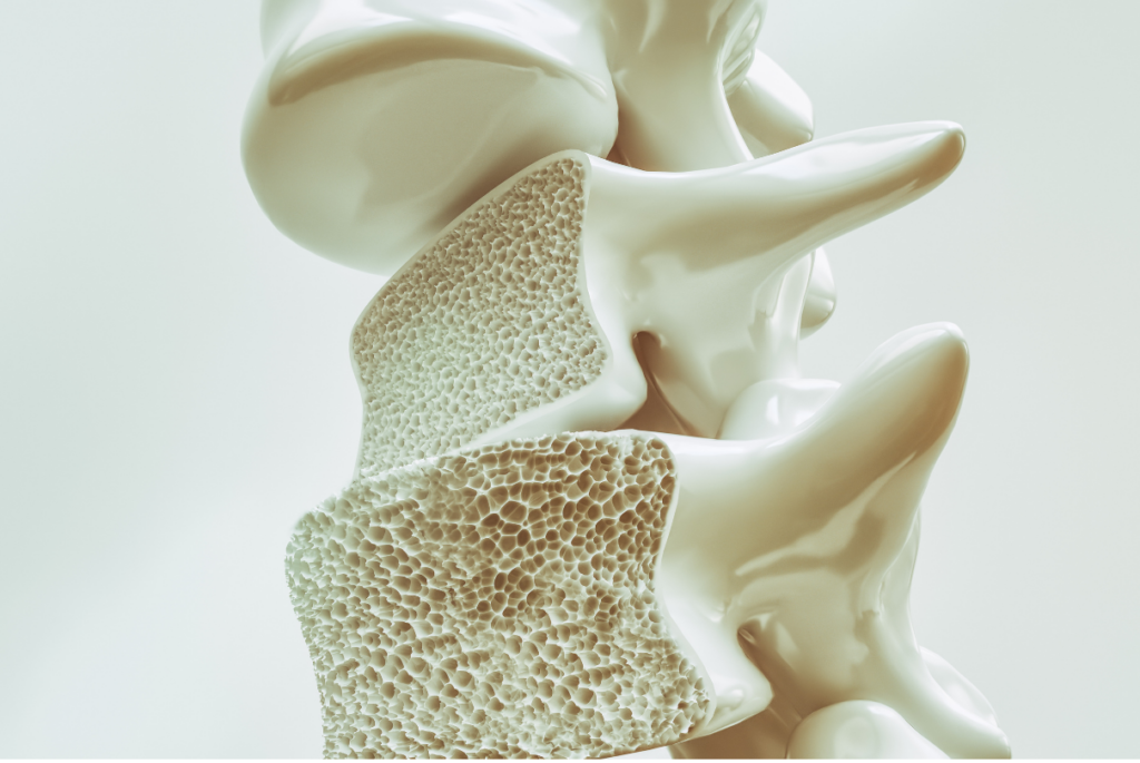 Coluna com osteopenia